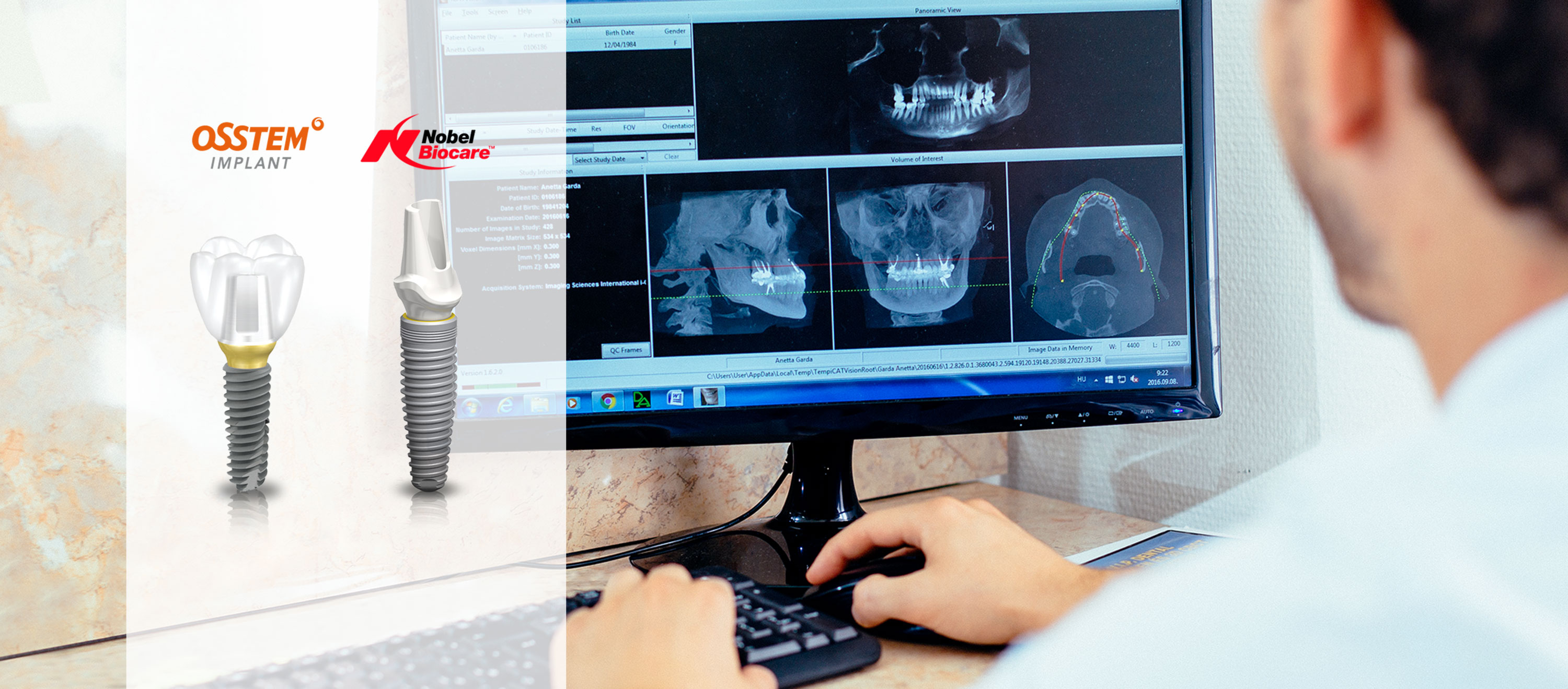 Fájdalommentes implantációs fogpótlás. DR. Varajti Artúr fogorvos, szájsebész néz egy röntgen felvéltel a számítógépen.