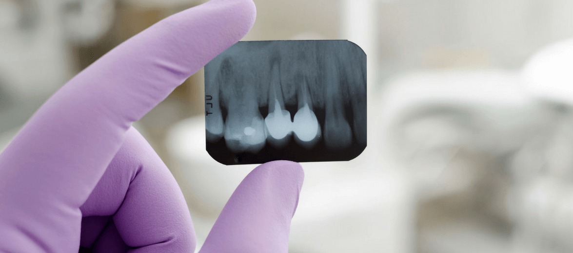 Zahnröntgen in der Artdent Zahnklinik